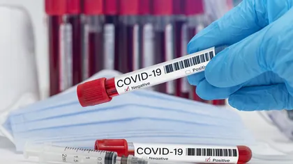 Bilanţ coronavirus 27 ianuarie. Aproape 3.200 de cazuri COVID în 24 de ore şi 77 de decese. Capitala se menţine în scenariul galben