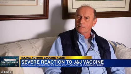 Reacţie adversă severă după vaccinul Johnson&Johnson: unui bărbat i-a căzut pielea