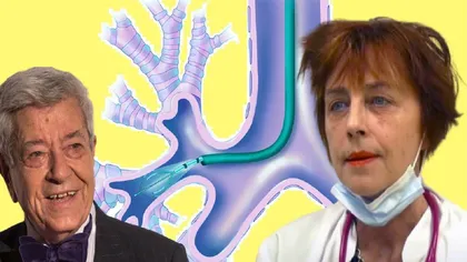 Medicul Flavia Groşan vine cu explicaţii despre endoscopia bronşică, intervenţia în timpul căreia actorul Ion Dichiseanu s-ar fi infectat cu o bacterie periculoasă