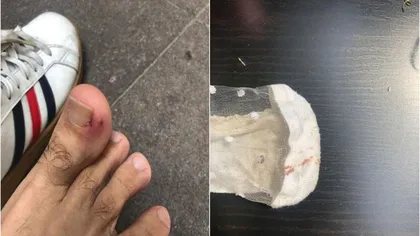 Situaţie şocantă în Capitală. Un bucureştean de 26 de ani a fost muşcat de un șobolan, în Piața Romană