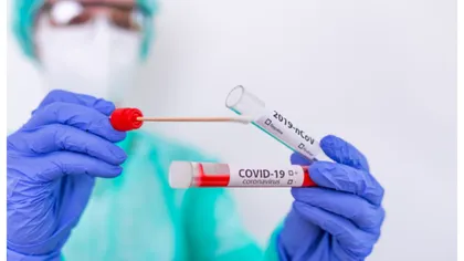 Cât timp avem anticorpi COVID-19 după infectare. Studiu