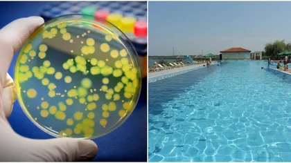 Bacterie periculoasă, rezistentă la antibiotice, descoperită de ANPC într-o piscină. Risc de pneumonie și infecții ale sângelui