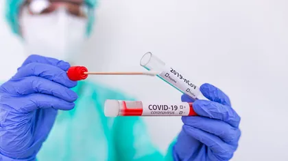 Bilanţ coronavirus 17 august. Aproape 550 de noi infectări COVID. Cel mai mare număr de cazuri din ultimele trei luni.