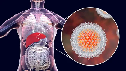 Tratamentul pentru hepatita C, decontat de CNAS începând din luna februarie
