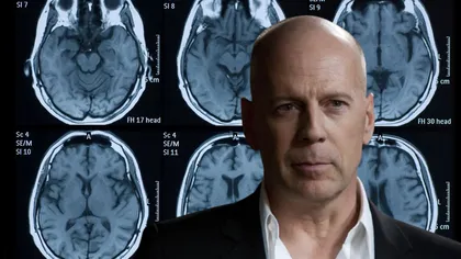 Bruce Willis, diagnosticat cu o afecțiune gravă a creierului. Actorul de 67 de ani renunță la actorie