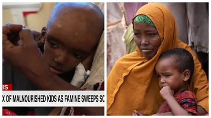 Imaginile foametei! Mamele din Somalia își îngroapă copiii morți de malnutriție! Efectele ucigătoare ale războiului pe care nu le vezi la televizor! 92% din hrana lor venea din Rusia și Ucraina
