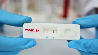 Bilanţ coronavirus 23 august. Aproape 5.700 de noi infectări şi 47 de decese COVID-19 în 24 de ore