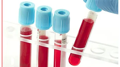 Un simplu test de sânge ar putea identifica mai multe tipuri de cancer înainte să apară simptome. Studiul care revoluţionează lumea medicală