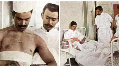 Alexandru Tzaicu-primul chirurg român care s-a operat singur. „Simt o senzație plăcută, de la basin în jos”
