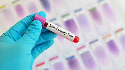 S-a descoperit o nouă grupă sanguină. Sunt doar 13 oameni în lume care au grupa Er