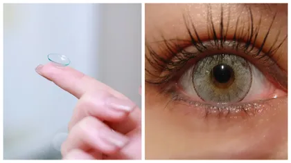 HALUCINANT! O femeie a uitat 23 de lentile de contact într-un ochi. Care este starea ei de sănătate