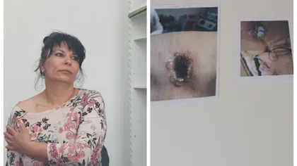 Pacientă arsă în aparatul RMN, la o clinică privată. O femeie a trecut prin clipe de coșmar
