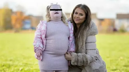 O fetiță de 5 ani cântărește 44 de kilograme, deoarece nu se poate opri din mâncat. Boala rară cu care a fost diagnosticată