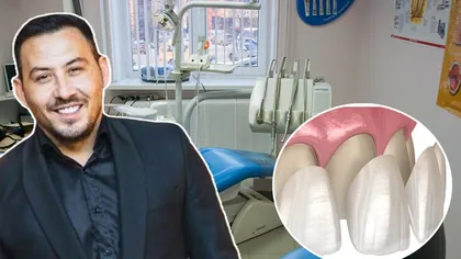 Ştefan Stan, la un pas să îşi piardă viaţa din cauza unor faţete dentare: 