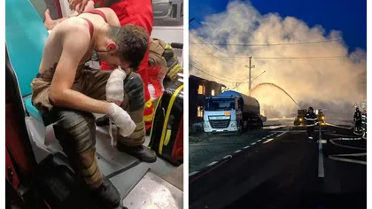 Sindicatul Europol postează imaginea unui pompier rănit: 