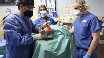 Al doilea transplant istoric de inimă de porc la un pacient viu a fost realizat în SUA