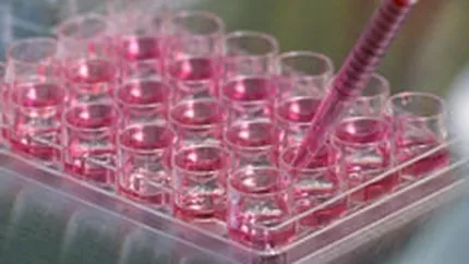 Cord Blood Center lanseaza un credit pentru celule stem