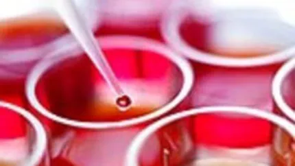 Prima banca de celule stem din Romania si-a crescut usor afacerile in 2010, la 4 mil. euro