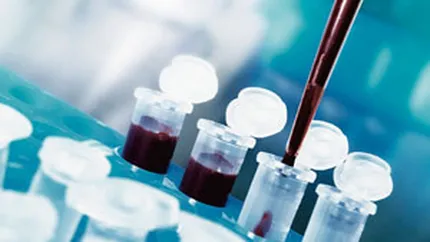BCR vrea sa vanda 5.000 de asigurari pentru interventii medicale cu celule stem in acest an