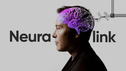Elon Musk a promis! Șase luni ne mai despart de implanturi conectate în creierul uman. Neuralink dezvoltă această tehnologie!