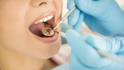 Un dentist în România câștigă zeci de mii de euro. Cu toate astea, cei din acest sector se vor putea bucura de o majorare de 40%