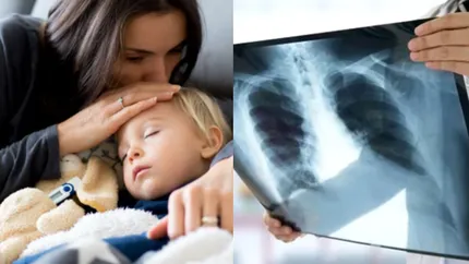 România, în topul deceselor cauzate de afecțiuni respiratorii!