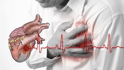 Veste bună pentru persoanele cu risc de probleme cardiace. Un nou tratament, care constă într-o injecție la 6 luni, poate preveni riscul de atac de cord