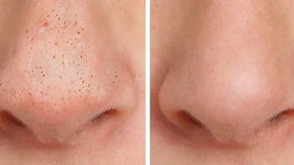Exfoliantul natural de 7 lei care elimină punctele negre. Truc eficient pentru un ten curat, fără produse scumpe