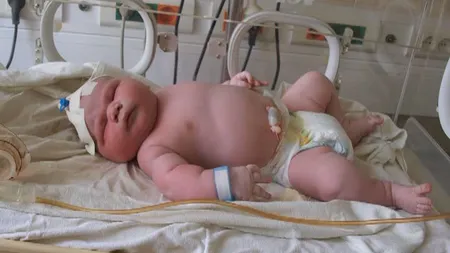 Un bebeluş de peste cinci kilograme s-a născut la Constanţa