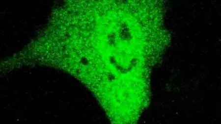 Zâmbetul ironic al unei celule canceroase - FOTO