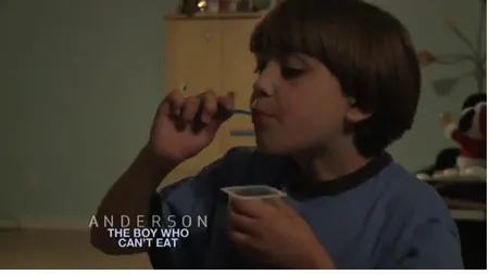 Un băieţel de nouă ani din America este alergic la mâncare VIDEO