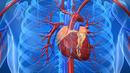 Factori ai infarctului miocardic