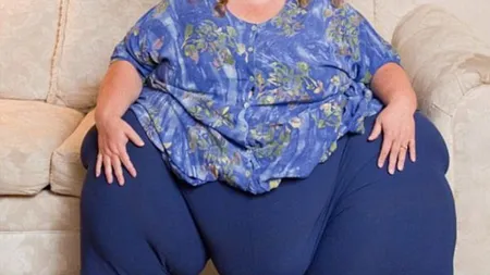 Cea mai grasă femeie din lume slăbeşte prin 