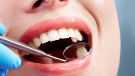 S-a inventat pasta de dinţi care REPARĂ cariile
