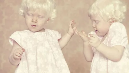 Fotografii impresionate: Copii şi adulţi bolnavi de albinism, surprinşi în imagini de artă