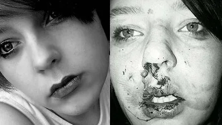 IMPRESIONANT: O adolescentă a devenit MODEL după ce a fost mutilată de nouă colegi