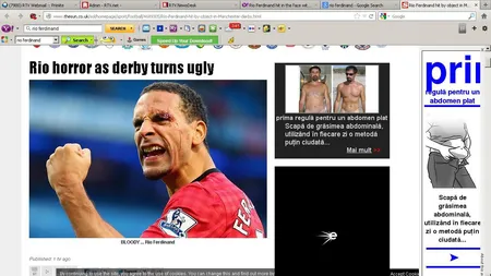 Huliganism la derby-ul din Manchester. Un spectator i-a spart capul lui Rio Ferdinand