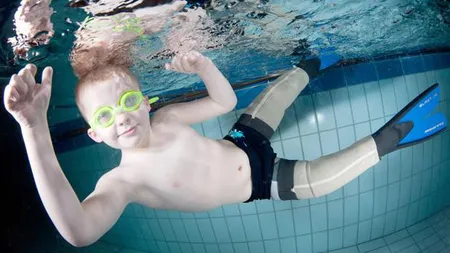 Povestea lui Flipper, băieţelul fără picioare al cărui unic vis era să înoate