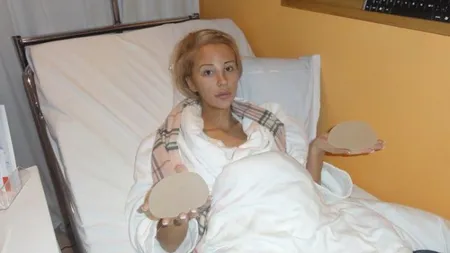 O tânără din Suedia a ieşit din spital după 12 OPERAŢII ESTETICE. Uite cum arată acum FOTO