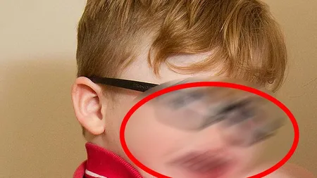 Povestea TRISTĂ a unui copil care nu se poate opri din ZÂMBIT, din cauza unei boli EXTREM de rare FOTO