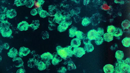 Microorganism LETAL, în apa de la robinet: Amiba care 