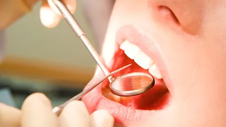 Durerile dentare urmează să fie tratate gratuit la Urgenţă începând cu anul 2014