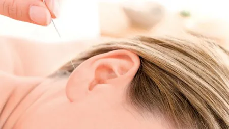 Cum slăbeşti cu ajutorul acupuncturii