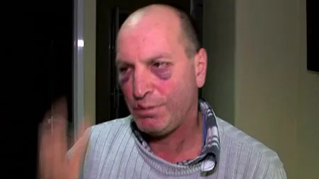 Un vasluian îi acuză pe poliţişti că l-au bătut cu bestialitate