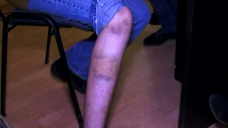 Un bărbat din Bârlad şi-a bătut copiii cu o ţeavă