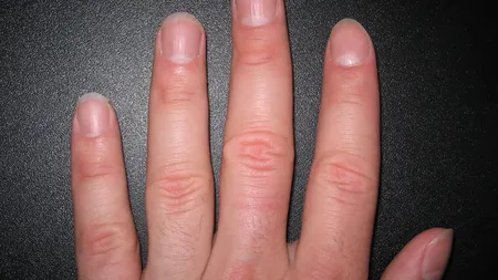 Ce spun unghiile despre sănătatea ta: Poţi afla dacă eşti bolnav doar uitându-te la ele