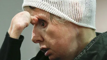 Femeia MUTILATĂ de un cimpanzeu cere daune de 150 de milioane de dolari FOTO&VIDEO