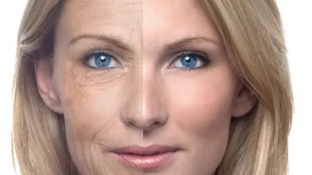 Cum îţi afectează ridurile expresiile feţei