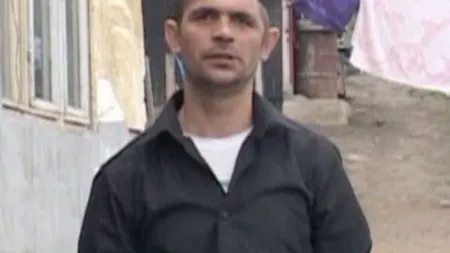 Românul care trăieşte cu o JUMĂTATE DE CAP i-a sensibilizat pe britanici. Povestea sa a ajuns în presa engleză