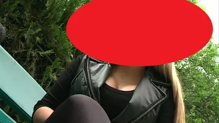 Dosarul SILICOANELOR. Un cunoscut fotomodel povesteşte CALVARUL prin care a trecut după operaţie VIDEO